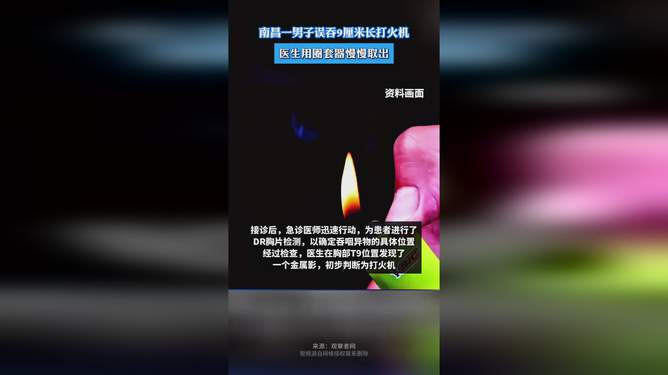 男子误吞9cm打火机视频，惊魂一刻与警示深思_词语解释