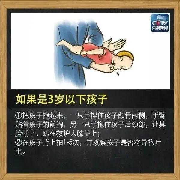 幼儿遭食物卡喉深圳医生5秒速救，生命的奇迹与医疗英雄的光辉时刻