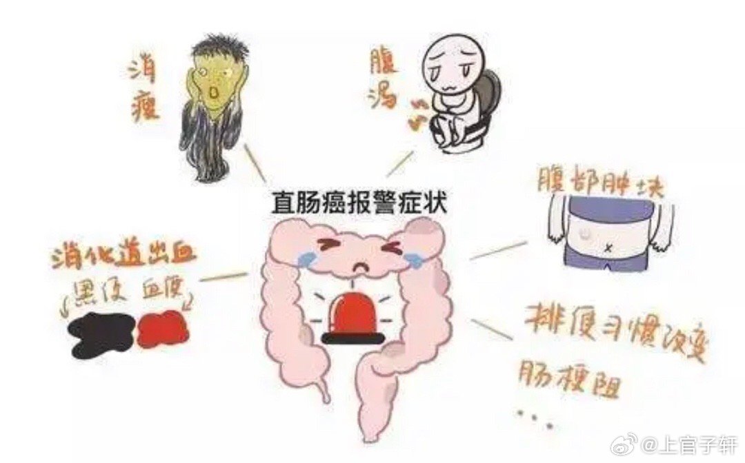 腹泻几天确诊结肠癌