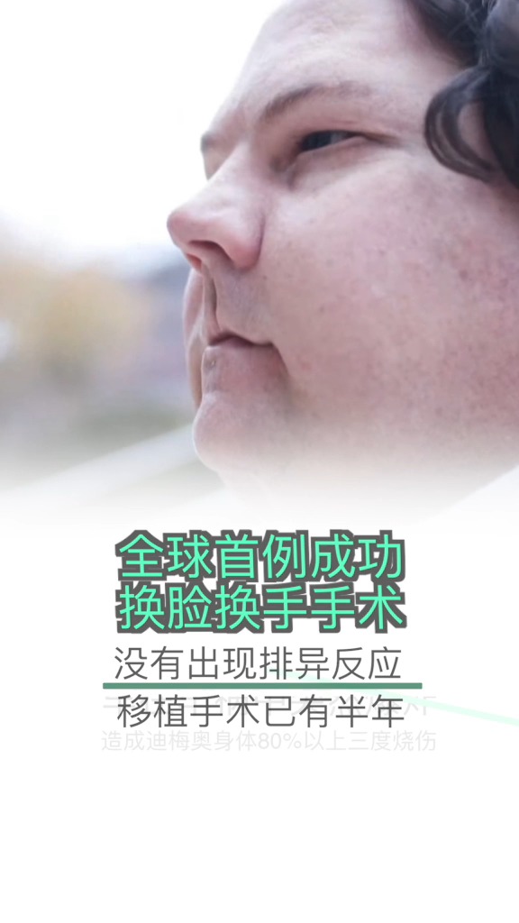 全球首例换脸换手男子婚礼，奇迹背后的故事